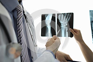 Surgeon pointing to x-ray photo