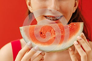 A close-up of a female teenager mouth with dental braces and a piece of delicious watermelon. The smile of a cute teen girl eating