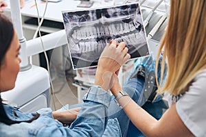 Close up of females that discussing quality of teeth