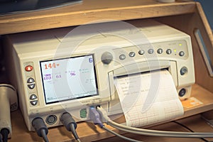 Close-up fetal monitor with baby heart beats at labor room hospital