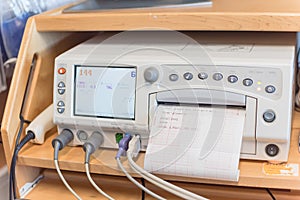 Close-up fetal monitor with baby heart beats at labor room hospital