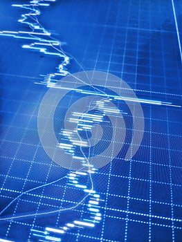 Close up of finance business graph which including of Up trend and Down trend. Abstract graphs and statistics in a modern city sky