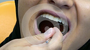 Close up footage of a patients mouth and a dentist checking his teeth