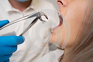 close-up of forceps for extraction of teeth and a tooth in them. The concept of going to the dentist.