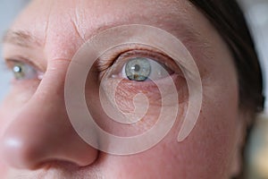 Close up and front view on the blue eye of a mature caucasian woman in her forties, showing heavy wrinkles crow`s feet in the