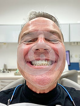 Close up front view of a man showing his new teeth