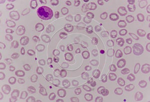 Giant platelet on red blood cells background. photo