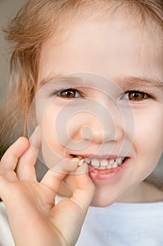 Close up girl with fallen milk tooth in hand.