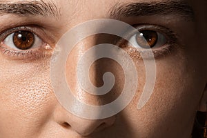 Close-up of a girl`s face with brown eyes, freckles and enlarged pores photo