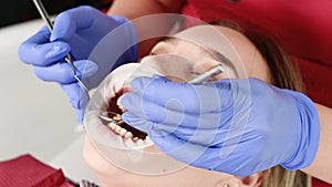 A close-up of the girl`s face is examined by a dental examiner with his mouth open and a napkin and eyes closed. Dentist