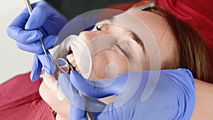 A close-up of the girl`s face is examined by a dental examiner with his mouth open and a napkin and eyes closed. Dentist