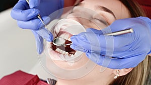 A close-up of the girl`s face is examined by a dental examiner with his mouth open and a napkin and eyes closed. Dentist