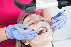 A close-up of the girl`s face is examined by a dental examiner with his mouth open and a napkin and eyes closed. Dentist