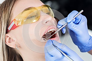 A close-up of the girl`s face is examined by a dental examiner with his mouth open and a napkin and eyes closed. Dentist