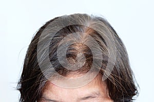 Close up gray hair or hoary hair of elderly asian woman on a white