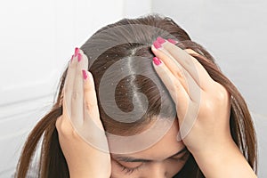 Close up hair at the dandruff on brown female hair