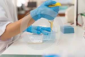 Close-up for hand woman holding autopipette liquid solution in a