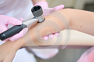 Close-up hands of beautician examine skin on arm with dermatoscope