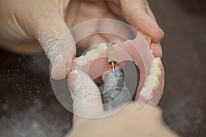 Close up of hands dental technician make denture prothesis in de