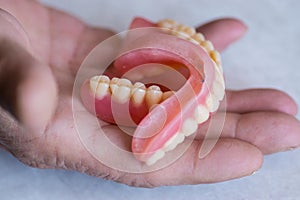 Close-up in the hands of a man removable dentures. Dental prosthetics. false jaw taken in hand. Dental practice.Selective focus