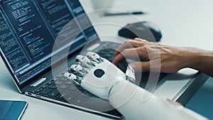 Close-up on Hands: Programmer With Disability Using Prosthetic Arm to Work on Laptop Computer