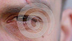 Close-up of handsome male eye is looking at the camera - the eyebrow is cut and the bruise under the eye