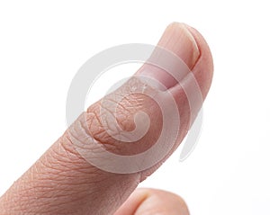 A close-up of a hangnail on a white background photo