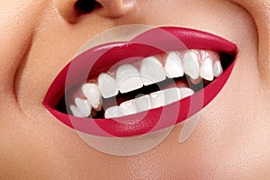 Close-up Happy Smile with Healthy White Teeth, Bright Red Lips Make-up. Cosmetology, Dentistry and Beauty care photo