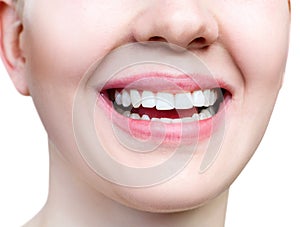 Close-up healthy smile of young woman. Perfect white teeth.