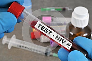 HIV test in close-up