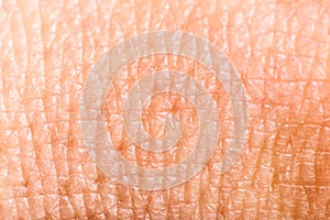 Close up human skin. Macro epidermis