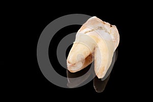 Close up image of bad tooth with caries dental plague with reflection on black