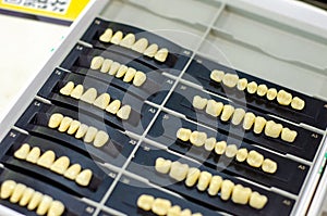 Close-up of implanted teeth. Denture manufacturing process photo