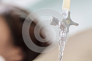Close up of infusion bottle with IV solution
