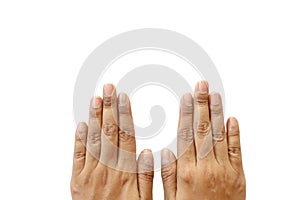 Close up isolated dirty nails of Asian woman on white background have copy space for put text. Concept unhealthy