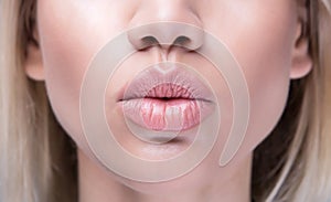 Close up kissing lips