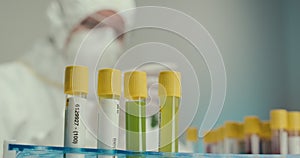 Close-up Laboratory scientist laboratory assistant gloves test tubes pipette virus reagents vaccine comparison