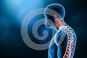 Close-up lateral or profile view of man with kyfosis 3D rendering illustration with copy space. Curvature of the spine disorder,