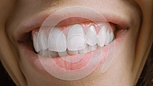 Close Up Macro Shot of a Mouth with Perfect White Teeth. Person Smiles. Female with Beat