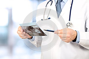 Close-up Of Male Doctor Pointing At Teeth X-ray