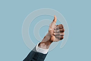 Close up of male hands with vitiligo pigments isolated on blue studio background