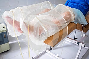 Ozone therapy treatment on legs of man photo