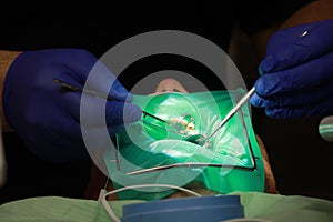 Close up of man open mouth while doctor is using mirror for better teeth examination. Careful male doctor applying at the patient