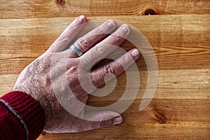 close-up of a man& x27;s hand with obsessive compulsive onychophagy disorder