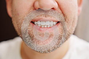 close-up. the man's mouth with stubble smiles and shows white teeth.