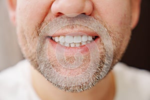 close-up. the man's mouth with stubble smiles and shows white teeth.