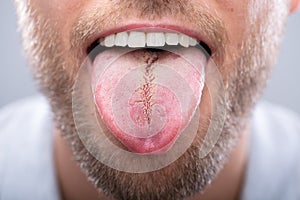 Close-up Of A Man`s Tongue