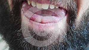 Close-up of a man showing his tongue and teeth.