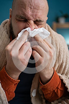 close-up of a man suffering from a runny nose sitting at home wiping his nose with a paper napkin. Cold and flu