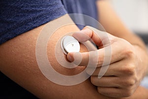 Man Testing Glucose Level With A Continuous Glucose Monitor